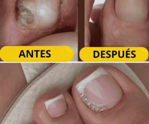 Ella Nunca Más Le Salieron Hongos En Las Uñas ¿La Razón? Porque Sabía Preparar Esto