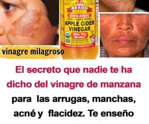 Propiedades del vinagre de manzana