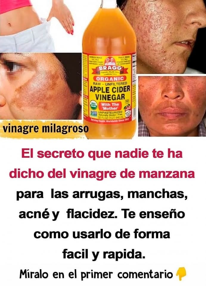 Propiedades Del Vinagre De Manzana Natureview