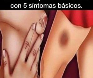 5 Síntomas que pueden estarte indicando que tienes LEUCEM1A y no lo sabías