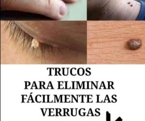 Olvídate de las cirugías: esto es lo que tienes que hacer para eliminar una verruga de tu cara