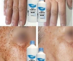 Increíbles usos del agua oxigenada que seguro no conocías.