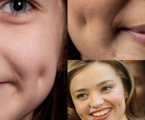 ¿Sabías que los hoyuelos en las mejillas son más que una característica adorable?