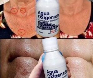 Increíbles usos con Agua Oxigenada que nadie te dijo!