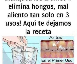 Quita el sarro de tus dientes y blanquéalos con esta simple receta.