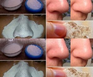Cómo eliminar los puntos negros de forma natural de tu rostro