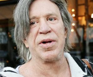 Obsesión por la cirugía estética deforma a ícono de Hollywood