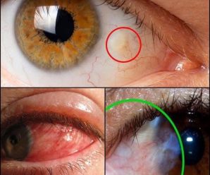 Mucha atención: Si tus ojos tienen estas señales, tu cuerpo está enviando una advertencia