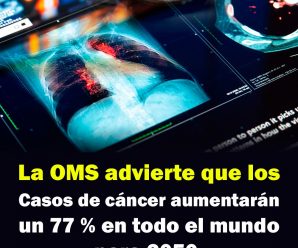 La OMS advierte que los casos de cáncer aumentarán un 77 % en todo el mundo para 2050.