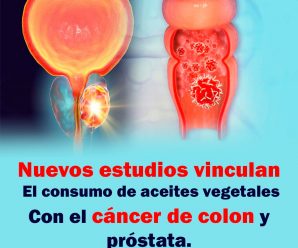 Estudios vinculan el consumo de aceites vegetales con el cáncer de colon y próstata.