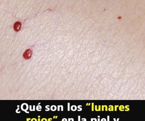 ¿Qué son los puntos rojos que aparecen en la piel?.