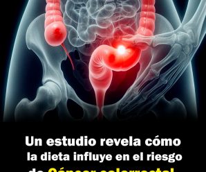 Un estudio revela cómo la dieta influye en el riesgo de cáncer colorrectal.