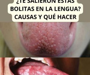 Lo que tu lengua revela sobre tu salud: señales que no debes ignorar…