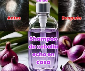 receta efectiva para hacer un **shampoo de cebolla morada casero**