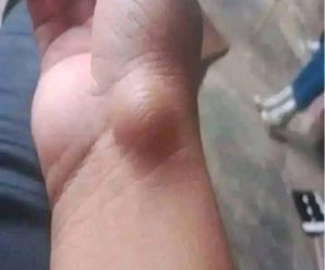 Mucha atención a estos síntomas porque puede ser algo más grave de lo que parece