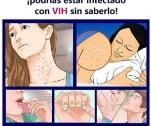 VIH: Los Primeros Síntomas que No Debes Ignorar.