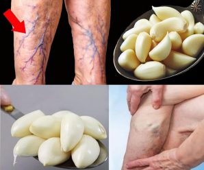 Remedio increíble: ajo para las varices y la inflamación