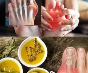 8 Maneras Fáciles de Eliminar el Exceso de Ácido Úrico: Recetas Naturales y Consejos Prácticos