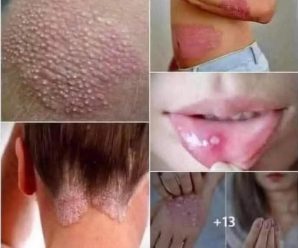 Lo que necesidas de saber acerca del Virus del Papiloma Humano