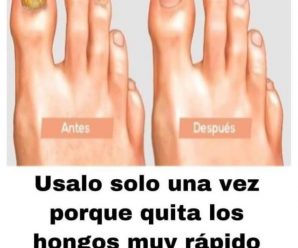 El Secreto Natural para Uñas Sanas Adiós a los Hongos de Forma Definitiva.