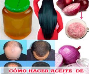 «El Poder del Aceite de Cebolla para un Cabello Más Fuerte y Saludable»