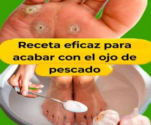 «Elimina el ojo de pescado con estos remedios naturales a base de ajo»