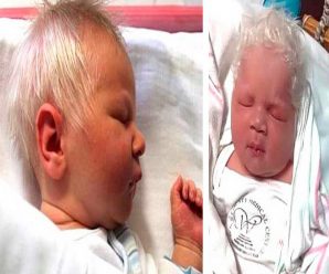 El asombroso caso del niño que nació con el cabello blanco