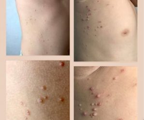 Si Esto Aparece en Tu Cuerpo, Presta Atención: Podría Ser una Señal de Alerta