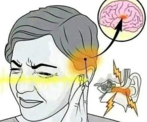 ¿Escuchas un Zumbido en el Oído? Descubre Qué Puede Significar