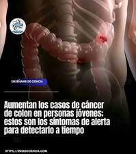 Síntomas de Cáncer de Colon que No Debes Ignorar.