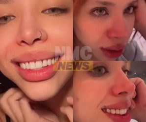 VIDEO: Yeri Mua se somete a doloroso tratamiento para hacer más pequeños sus dientes