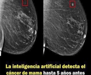 Inteligencia artificial puede detectar el cáncer de mama en etapas iniciales en las mamografías