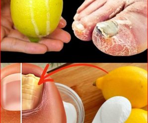 Elimina los Hongos de Forma Natural con Limón y Bicarbonato