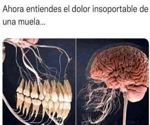 Causas de un dolor intenso de muelas
