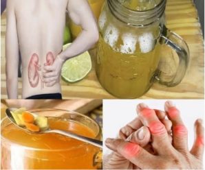 Té de Cúrcuma: La Receta Secreta para Limpiar tus Riñones, Embellecer tu Piel y Mejorar 10 Afecciones de Salud