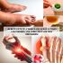 El mejor té para piernas hinchadas: diurético natural para tobillos y pies