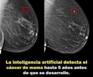 Inteligencia artificial puede detectar el cáncer de mama en etapas iniciales en las mamografías