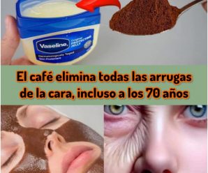 Raíz de Diente de León: Beneficios, Usos y Precauciones