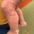 Pensó que era una simple alergia, pero su cuerpo le estaba avisando otra cosa