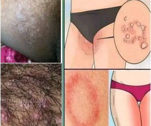 ALERTA MÉDICA: Si Tienes PICAZÓN en Estos 3 LUGARES, Tu ESPERANZA de VIDA Podría Ser CORTA