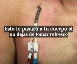 Esto le pasará a tu cuerpo si no dejas de tomar refresco.Comparte este mensaje con quien más quieras. Puede salvar vidas…Ver más