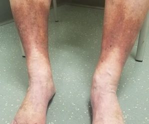 Señales en tus PIES que indican…Ver más