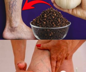 Ajo y Clavos de Olor: El Remedio Natural para las Várices y la Circulación