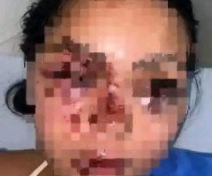 Hoy en la tarde golpearon a la hija…ver más