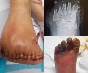 He aquí las graves consecuencias de dormir con… Ver más