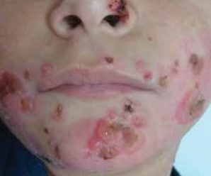 Estas son las señales de que está c… Ver más