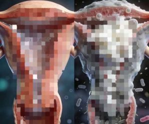 Estas son las consecuencias de tener relaciones por… ver más