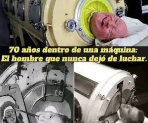 Paul Alexander vivió 70 años en un pulm…Ver más