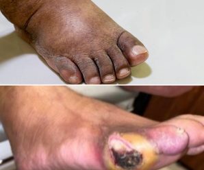 Estes são os primeiros sintomas de uma… Ver mais