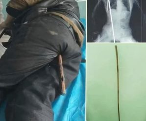 😱Joven fue hospitalizado tras ser pen… Ver más